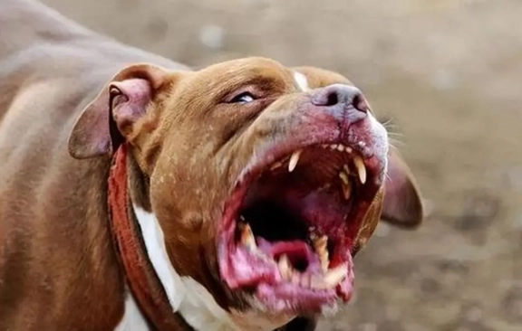 比特犬攻擊預防 比特犬攻擊預防